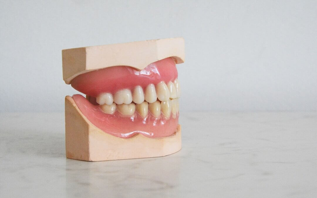 Are Dentures Painful? A Versailles Dentist Answers