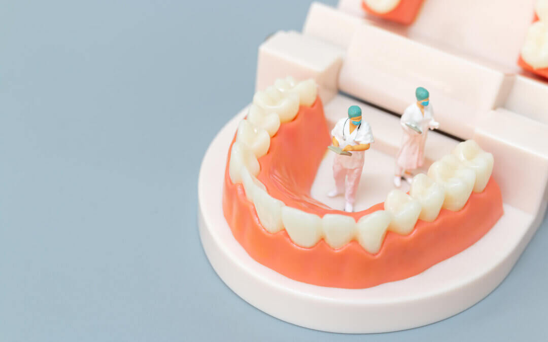 Do You Need Deep Teeth Cleaning? Advice From a Dentist in Versailles, KY
